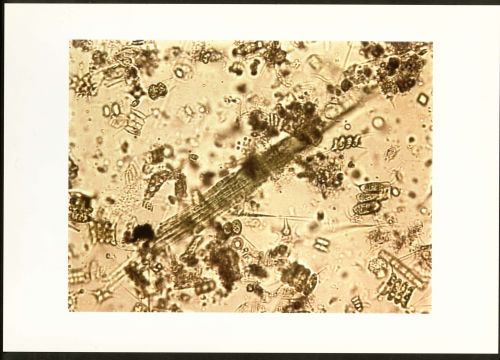 Cyanophycées prélevées dans les lacs du bois de Vincennes, 5 juillet 2000. Archives de Paris, 3625W 21.