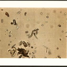 Spores de champignons prélevés sur une blessure d&#8217;arbre, 27 juin 2000. Archives de Paris, 3625W 21.